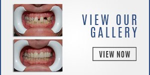 dentist-gallery-miami