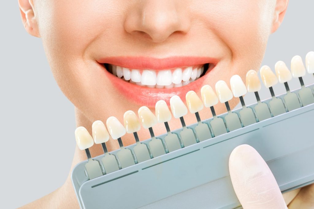 Cosmetic dentistry includes teeth implants.