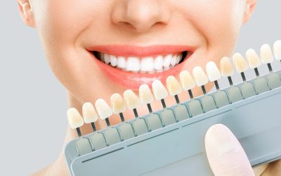 Cosmetic dentistry includes teeth implants.