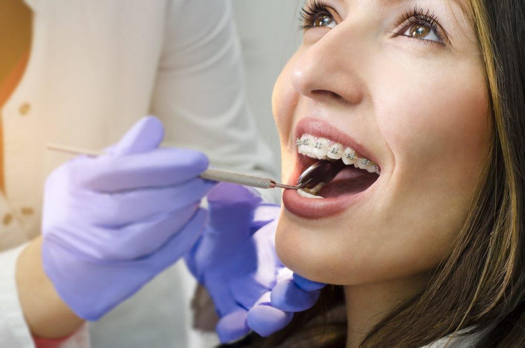 Woman getting teeth whitening treatment for her braces