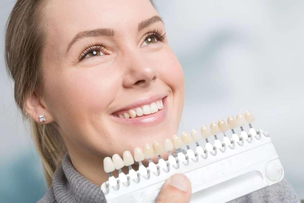 teeth whitening veneers